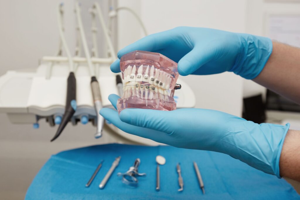 fiksna proteza ortodoncija