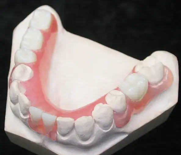 Na slici je prikazan model zubne proteze, verovatno vrste koja se naziva Valplast. 